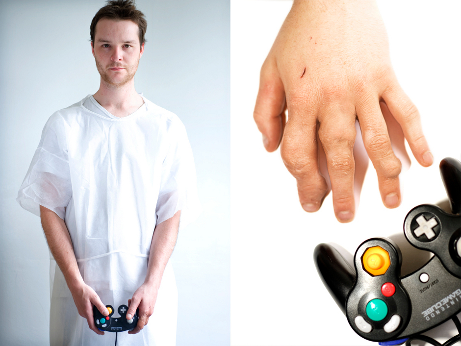 Руки геймера. Пальцы геймера. Зависимость от компьютерных игр. Пальцы после игры
